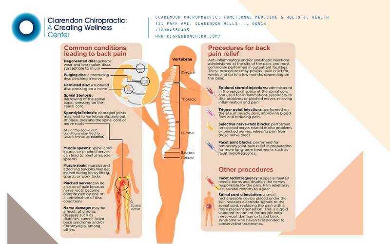 backpain diagram causes and cures